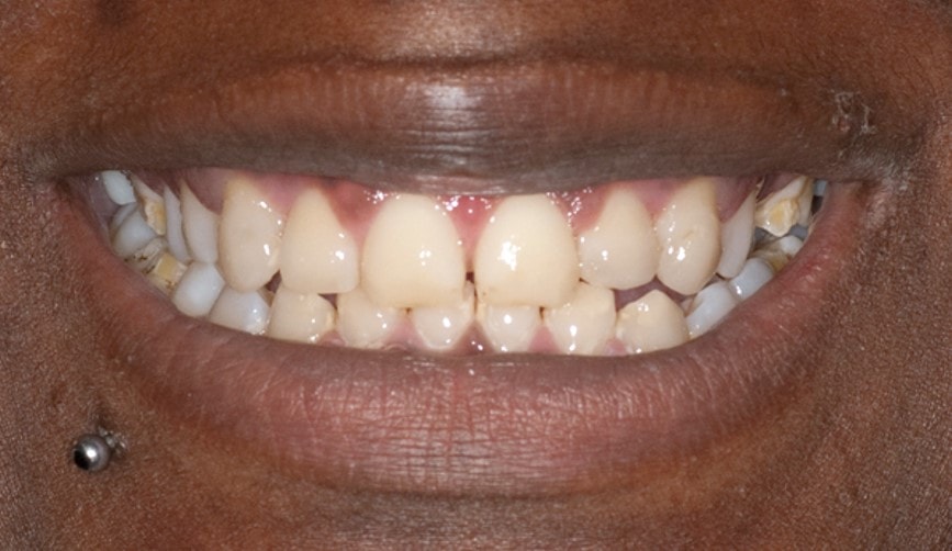 smile design cosmetic dentist